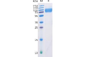 Human DNAM-1 Protein, mFc-His Tag on SDS-PAGE under reducing condition.