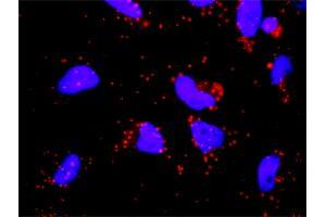 Proximity Ligation Analysis of protein-protein interactions between GP1BA and F12.