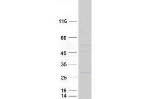 Validation with Western Blot
