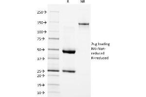SDS-PAGE Analysis Purified EGFR Mouse Monoclonal Antibody (GFR/1667). (EGFR anticorps)
