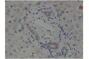 anti-GLIS Family Zinc Finger 2 (GLIS2) (N-Term) antibody