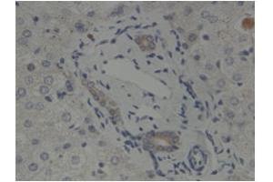 Sample Type:  Human Bile DuctPrimary   Dilution:  1:500 (GLIS2 anticorps  (N-Term))