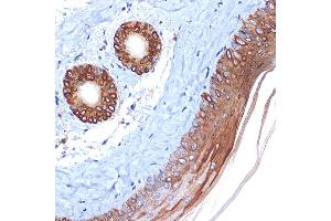 Immunohistochemistry of paraffin-embedded mouse skin using Cytokeratin 2e (KRT2) Rabbit mAb (ABIN1680763, ABIN3016322, ABIN3016323 and ABIN7101480) at dilution of 1:100 (40x lens).