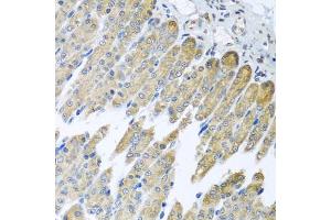 Immunohistochemistry of paraffin-embedded mouse stomach using NDUFB10 antibody (ABIN5972156) at dilution of 1/100 (40x lens). (NDUFB10 anticorps)