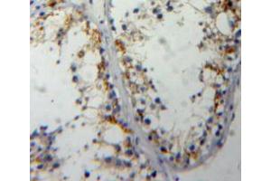 Used in DAB staining on fromalin fixed paraffin-embedded testis tissue (Cdc25 anticorps  (AA 376-524))