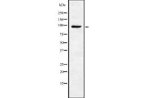Western blot analysis of TRPV4 using HeLa whole cell lysates (TRPV4 anticorps  (C-Term))