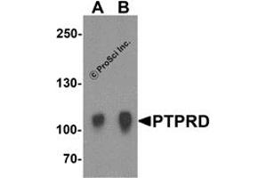 Western Blotting (WB) image for anti-Protein tyrosine Phosphatase, Receptor Type, D (PTPRD) (N-Term) antibody (ABIN1031529) (PTPRD anticorps  (N-Term))