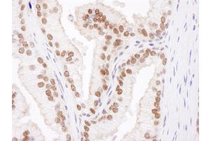 anti-Cullin 4B (CUL4B) (AA 863-913) antibody