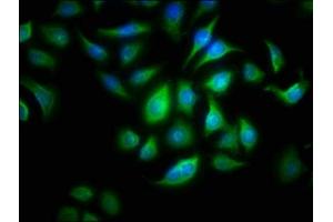 Immunofluorescence staining of A549 cells with ABIN7144534 at 1:166, counter-stained with DAPI. (ALOX15B anticorps  (AA 1-676))