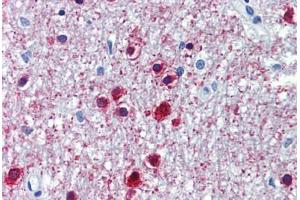 Human Brain, Cerebellum (formalin-fixed, paraffin-embedded) stained with ONECUT1 antibody ABIN462211 followed by biotinylated goat anti-rabbit IgG secondary antibody ABIN481713, alkaline phosphatase-streptavidin and chromogen. (ONECUT1 anticorps  (C-Term))