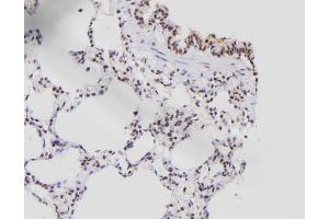 ABIN6276538 at 1/100 staining Rat lung tissue by IHC-P. (E2F8 anticorps  (C-Term))