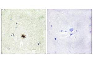 Immunohistochemistry (IHC) image for anti-Cysteine and Glycine-Rich Protein 1 (CSRP1) (Internal Region) antibody (ABIN1849240) (CSRP1 anticorps  (Internal Region))