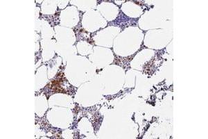 Immunohistochemical staining of human bone marrow with MEIG1 polyclonal antibody  shows strong cytoplasmic and nuclear positivity in subsets of hematopoietic cells at 1:200-1:500 dilution.