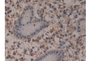 Detection of ANXA6 in Human Stomach Tissue using Polyclonal Antibody to Annexin A6 (ANXA6)