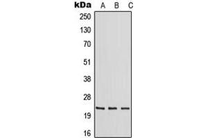 Western blot analysis of RAB30 expression in HeLa (A), mouse liver (B), rat liver (C) whole cell lysates.