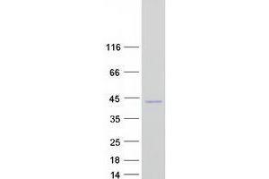 Validation with Western Blot