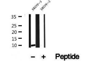 Western blot analysis of extracts of SKOV-3 cells, using SRP9 antibody. (SRP9 anticorps  (Internal Region))