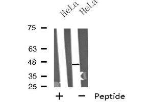 Western blot analysis of extracts from HeLa cells, using MTLR antibody. (Motilin Receptor anticorps  (C-Term))
