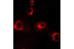 Immunofluorescent analysis of CD158b2 staining in HepG2 cells. (KIR2DL3 anticorps)