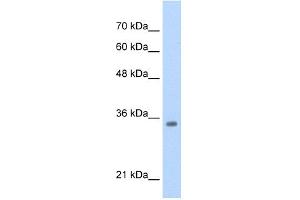 WB Suggested Anti-TCF4 Antibody  Titration: 0. (TCF4 anticorps  (N-Term))