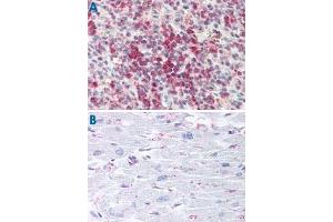 Immunohistochemistry (Formalin/PFA-fixed paraffin-embedded sections) of human spleen (A) and human heart tissue (B) with CYSLTR2 polyclonal antibody . (CasLTR2 anticorps  (C-Term))