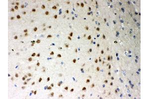 Immunohistochemistry (Paraffin-embedded Sections) (IHC (p)) image for anti-Protein Kinase C, iota (PRKCI) (AA 21-214) antibody (ABIN3043909)