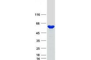 Validation with Western Blot