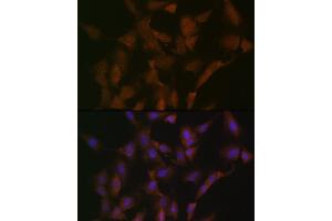 Immunofluorescence analysis of C6 cells using DISC1 Rabbit mAb (ABIN7266799) at dilution of 1:100 (40x lens). (DISC1 anticorps)