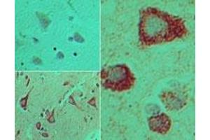 Image no. 1 for anti-Toll-Like Receptor Adaptor Molecule 2 (TICAM2) (AA 150-200) antibody (ABIN960372)