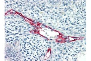 Immunohistochemistry (IHC) image for anti-Coagulation Factor VIII (F8) antibody (ABIN614478) (Factor VIII anticorps)