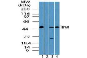 Image no. 2 for anti-K(lysine) Acetyltransferase 5 (KAT5) (AA 480-530) antibody (ABIN960242) (KAT5 anticorps  (AA 480-530))