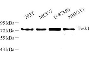 Western blot analysis of tesk1 (ABIN7075866) at dilution of 1: 500 (TESK1 anticorps)