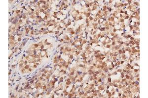 ABIN6267288 at 1/100 staining human seminoma tissue sections by IHC-P.