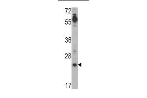 Western blot analysis of CRIPTO (TDGF1) Antibody (N-term) (ABIN388791 and ABIN2839123) in Jurkat cell line lysates (35 μg/lane). (TDGF1 anticorps  (N-Term))