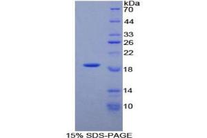 SDS-PAGE analysis of Human PLAA Protein. (PLAA Protéine)