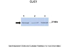 Lanes:   Lane 1: 30ug mouse renal epithelial lysate Lane 2: 30ug mouse renal epithelial lysate Lane 3: 30ug mouse renal epithelial lysate  Primary Antibody Dilution:   1:500  Secondary Antibody:   Anti-rabbit-HRP  Secondary Antibody Dilution:   1:2500  Gene Name:   CLIC1  Submitted by:   Dr. (CLIC1 anticorps  (C-Term))