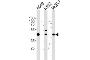 Western Blotting (WB) image for anti-General Transcription Factor IIH, Polypeptide 2C (GTF2H2C) antibody (ABIN2996187)