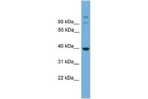 WB Suggested Anti-SUGT1 Antibody Titration: 0. (SUGT1 anticorps  (Middle Region))