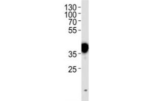 NPM1 antibody western blot analysis in HeLa lysate.