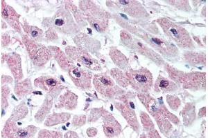 Anti-KCNJ3 antibody  ABIN1048661 IHC staining of human heart.