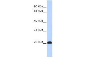 WB Suggested Anti-KLF16 Antibody Titration:  0. (KLF16 anticorps  (N-Term))
