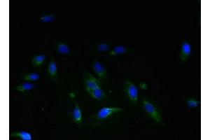 Immunofluorescent analysis of Hela cells using ABIN7159505 at dilution of 1:100 and Alexa Fluor 488-congugated AffiniPure Goat Anti-Rabbit IgG(H+L) (STEAP3 anticorps  (AA 1-207))