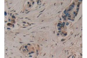 Used in DAB staining on fromalin fixed paraffin- embedded liver tissue (LIFR anticorps  (AA 45-184))