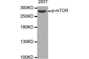 Western blot analysis of extracts of 293T cell line, using phospho-MTOR-S2448 antibody. (MTOR anticorps  (pSer2448))