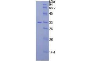 Image no. 1 for Janus Kinase 3 (JAK3) (AA 716-967) (Active) protein (His tag) (ABIN6239869)