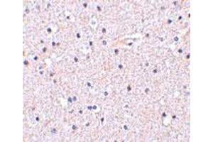 Immunohistochemistry of NCSTN in human brain tissue with NCSTN polyclonal antibody  at 5 ug/mL .