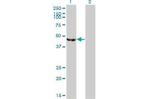 Western Blot analysis of ENO3 expression in transfected 293T cell line by ENO3 monoclonal antibody (M01), clone 5D1.