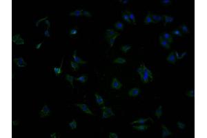 Immunofluorescence staining of HepG2 cells with ABIN7140016 at 1:100, counter-stained with DAPI.