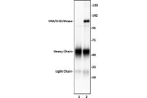OGA/O-GlcNAcase antibody (pAb) tested by Immunoprecipitation. (MGEA5 anticorps  (N-Term))