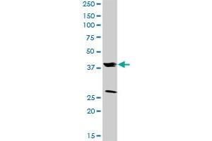 FRZB MaxPab rabbit polyclonal antibody.